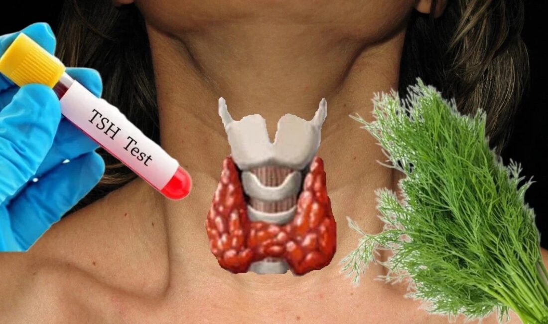 Tiroidler düzgün çalışmadığında metabolizma ve bağışıklık sistemi çöküşe geçer. Dengelemek