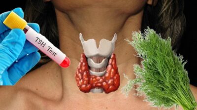 Tiroidler düzgün çalışmadığında metabolizma ve bağışıklık sistemi çöküşe geçer. Dengelemek