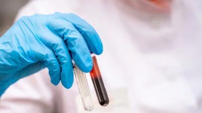 İç Hastalıkları ve Hematoloji Uzmanı Dr. Fatih Öçal, demir eksikliğinin