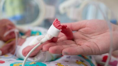 Minnacık yürekleri, elleri ve ayakları ile dünyaya tutunmaya çalışan prematüre