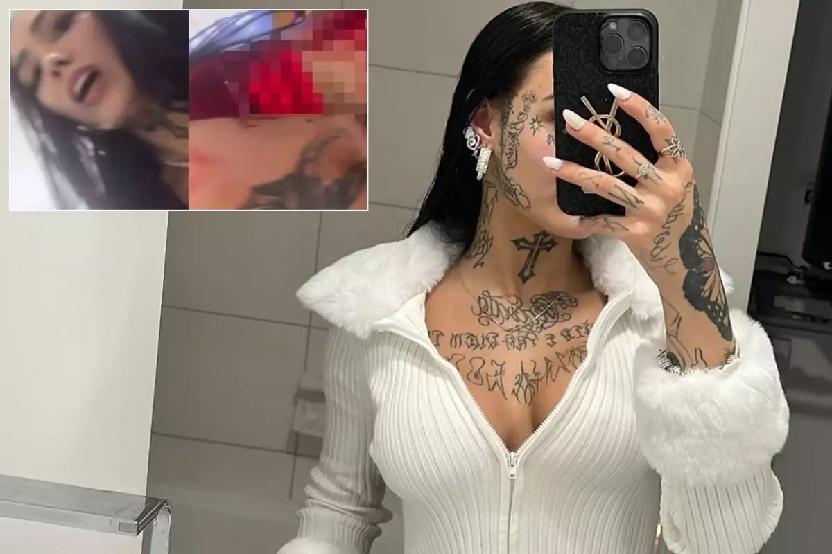 Brezilya'da sosyal medyayı sarsan korkunç bir olay yaşandı. 22 yaşındaki