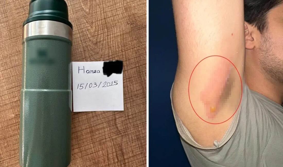 Dünyaca ünlü termos markasının kapak hatası nedeniyle başlattığı değişim sürecinde