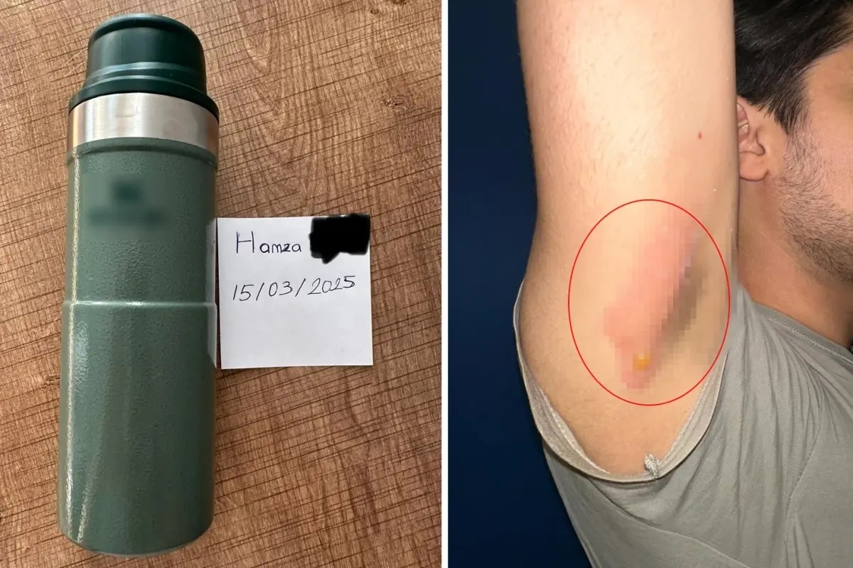 Dünyaca ünlü termos markasının kapak hatası nedeniyle başlattığı değişim sürecinde