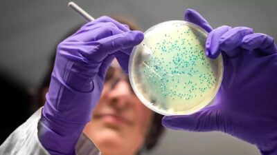 Araştırmacılar, yapay zekanın ilaca dirençli gonore ve MRSA bakterilerini öldürebilecek