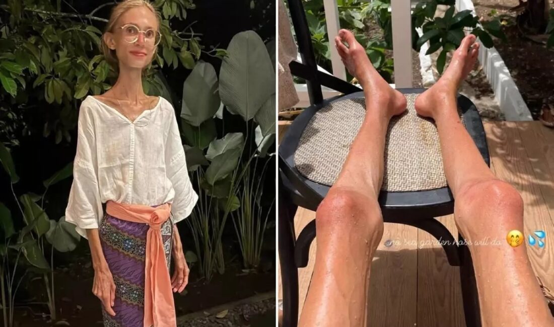 Uzun süredir meyve diyeti ile yaşamına devam eden ve son