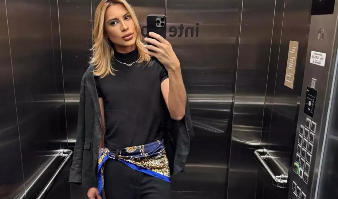 Brezilyalı moda fenomeni Junior Dutra (31), "fox eyes" estetiği sonrası