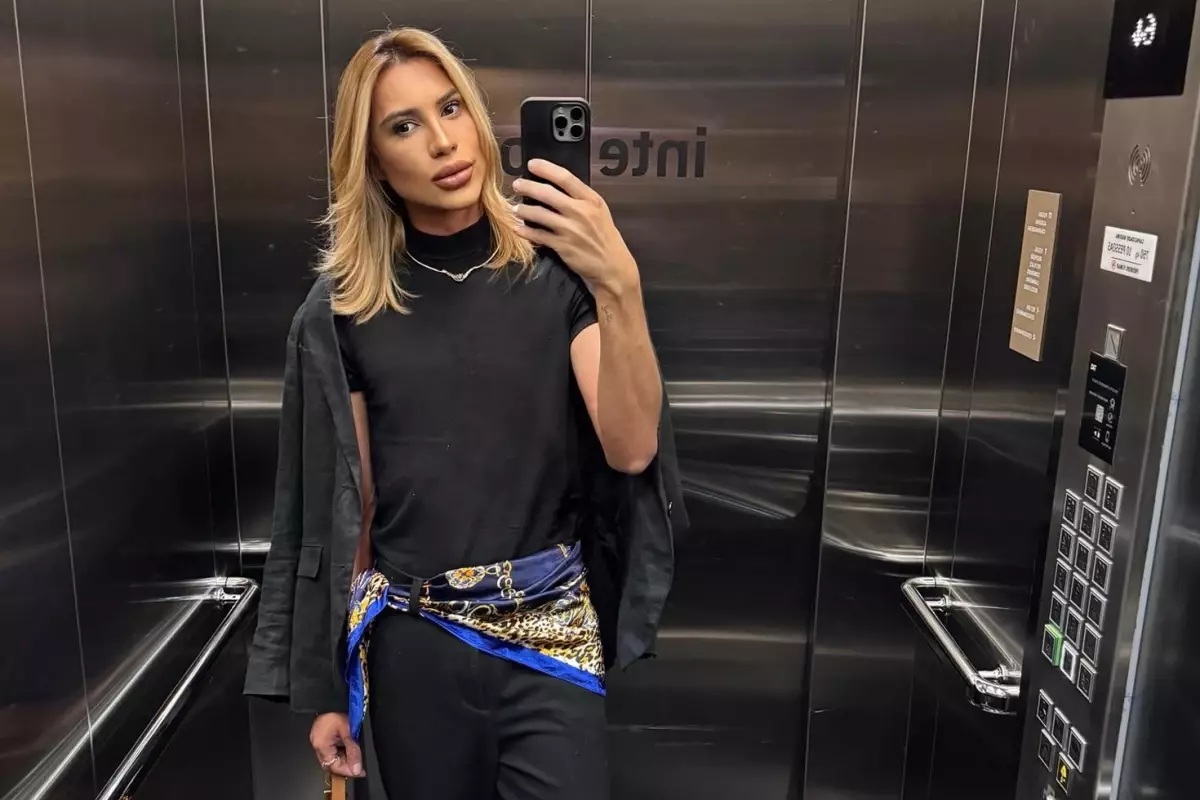 Brezilyalı moda fenomeni Junior Dutra (31), "fox eyes" estetiği sonrası