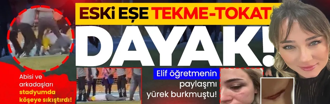 Zonguldak'ta boşandığı eşinden şiddet gördüğünü