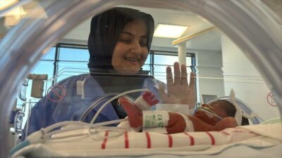 İzmir Şehir Hastanesi'nde yapılan başarılı fetal cerrahi ile ayrık omurgalı