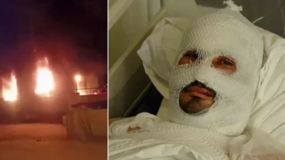 Hatay'da çıkan yangında ailesini kurtarmak için alevlerin arasına dalan Levent