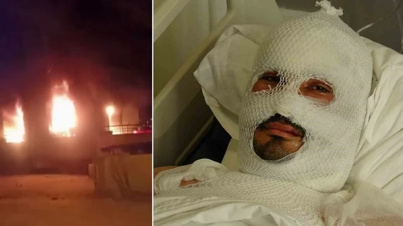 Hatay'da çıkan yangında ailesini kurtarmak için alevlerin arasına dalan Levent