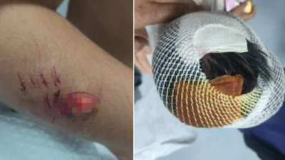 Şanlıurfa'nın Viranşehir ilçesinde okuldan dönen 8 yaşındaki S.B., sokak köpeklerinin
